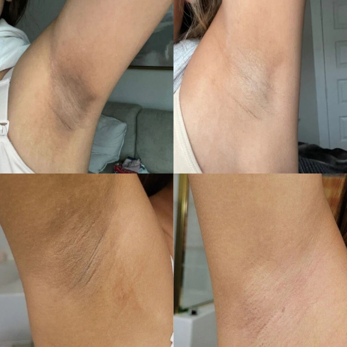 Peel Shot Spray złuszczający Tumereci