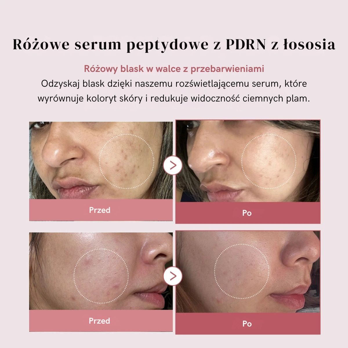PDRN Pink Serum Peptide – Głębokie nawilżenie, efekt "Glass Skin