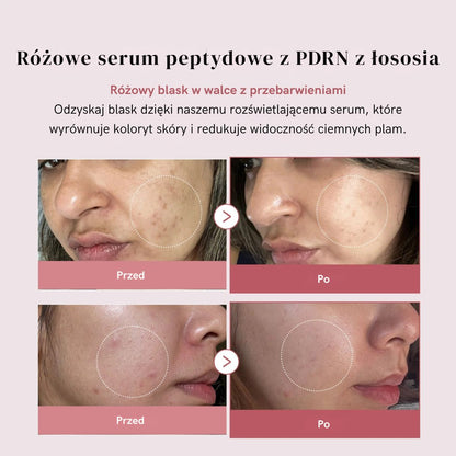 PDRN Pink Serum Peptide – Głębokie nawilżenie, efekt "Glass Skin
