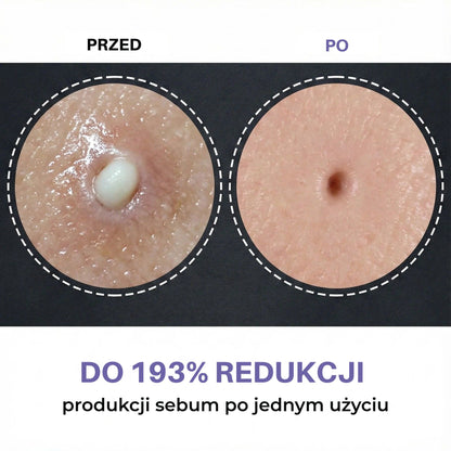PeelShot