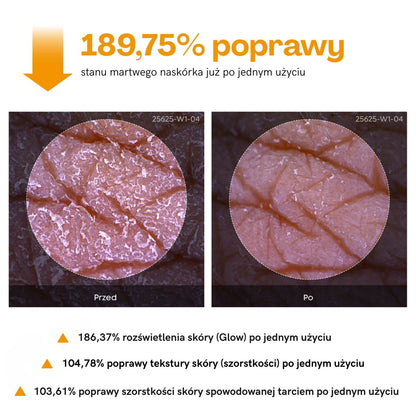 Peel Shot Spray złuszczający Tumereci